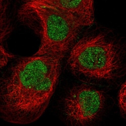 Invitrogen PCYT1A Polyclonal Antibody 100 &mu;L; Unconjugated:Antibodies,