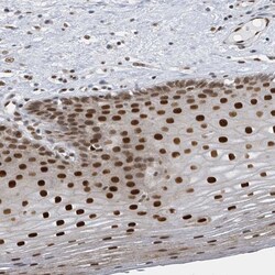 Invitrogen PCYT1A Polyclonal Antibody 100 &mu;L; Unconjugated:Antibodies,