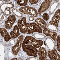 Invitrogen ECHDC1 Polyclonal Antibody 100 &mu;L; Unconjugated:Antibodies,