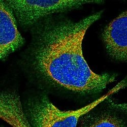 Invitrogen EHBP1 Polyclonal Antibody 100 &mu;L; Unconjugated:Antibodies,