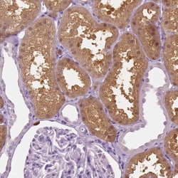 Invitrogen GALM Polyclonal Antibody 100 &mu;L; Unconjugated:Antibodies,
