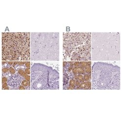 Invitrogen GALM Polyclonal Antibody 100 &mu;L; Unconjugated:Antibodies,
