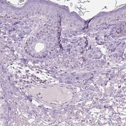 Invitrogen GALM Polyclonal Antibody 100 &mu;L; Unconjugated:Antibodies,