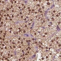 Invitrogen GALM Polyclonal Antibody 100 &mu;L; Unconjugated:Antibodies,