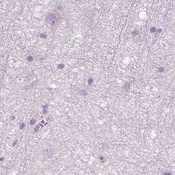 Invitrogen GALM Polyclonal Antibody 100 &mu;L; Unconjugated:Antibodies,