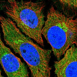 Invitrogen ADAT2 Polyclonal Antibody 100 &mu;L; Unconjugated:Antibodies,