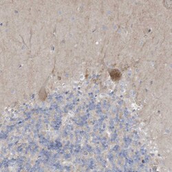 Invitrogen ADAT2 Polyclonal Antibody 100 &mu;L; Unconjugated:Antibodies,