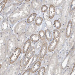 Invitrogen ADAT2 Polyclonal Antibody 100 &mu;L; Unconjugated:Antibodies,
