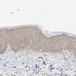 Invitrogen ADAT2 Polyclonal Antibody 100 &mu;L; Unconjugated:Antibodies,