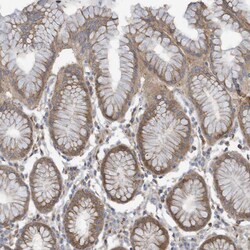 Invitrogen ADAT2 Polyclonal Antibody 100 &mu;L; Unconjugated:Antibodies,