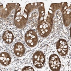 Invitrogen HNMT Polyclonal Antibody 100 &mu;L; Unconjugated:Antibodies,