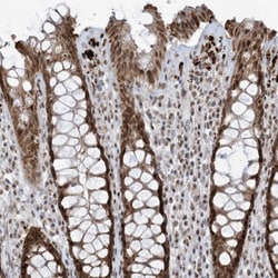 Invitrogen ECT2L Polyclonal Antibody 100 &mu;L; Unconjugated:Antibodies,