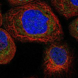 Invitrogen TTC21B Polyclonal Antibody 100 &mu;L; Unconjugated:Antibodies,