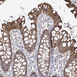Invitrogen TTC21B Polyclonal Antibody 100 &mu;L; Unconjugated:Antibodies,