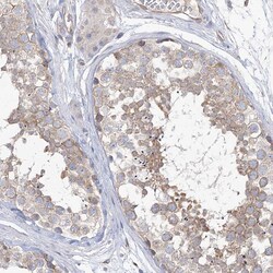 Invitrogen TTC21B Polyclonal Antibody 100 &mu;L; Unconjugated:Antibodies,