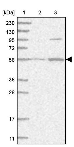 Invitrogen HACL1 Polyclonal Antibody 100 &mu;L | Buy Online | Invitrogen&trade; | Fisher Scientific
