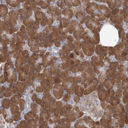 Invitrogen GMPPA Polyclonal Antibody 100 &mu;L | Buy Online | Invitrogen&trade; | Fisher Scientific