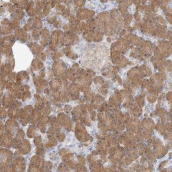 Invitrogen GMPPA Polyclonal Antibody 100 &mu;L; Unconjugated:Antibodies,