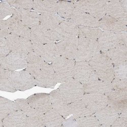 Invitrogen KIF15 Polyclonal Antibody 100 &mu;L; Unconjugated:Anticuerpos