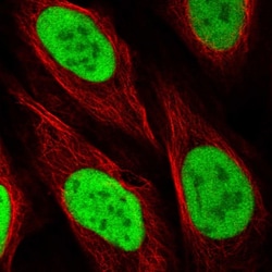 Invitrogen PPM1G Polyclonal Antibody 100 &mu;L; Unconjugated:Antibodies,