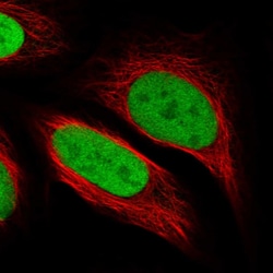 Invitrogen PPM1G Polyclonal Antibody 100 &mu;L; Unconjugated:Antibodies,