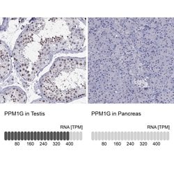 PPM1G Polyclonal Antibody, Invitrogen 100 &mu;L; Unconjugated:Antibodies,