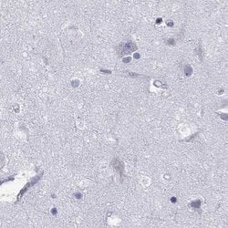 PPM1G Polyclonal Antibody, Invitrogen 100 &mu;L; Unconjugated:Antibodies,