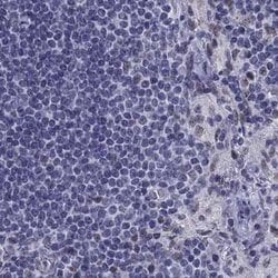 PPM1G Polyclonal Antibody, Invitrogen 100 &mu;L; Unconjugated:Antibodies,