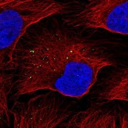 Invitrogen KISS1 Polyclonal Antibody 100 &mu;L; Unconjugated:Antibodies,