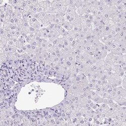 Invitrogen KISS1 Polyclonal Antibody 100 &mu;L; Unconjugated:Antibodies,