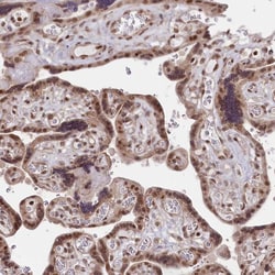 Invitrogen CGGBP1 Polyclonal Antibody 100 &mu;L; Unconjugated:Antibodies,