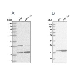 Invitrogen CGGBP1 Polyclonal Antibody 100 &mu;L; Unconjugated:Antibodies,