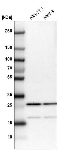 Invitrogen CGGBP1 Polyclonal Antibody 100 &mu;L; Unconjugated:Antibodies,