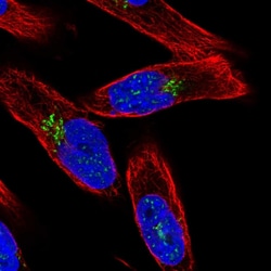 Invitrogen ZCCHC4 Polyclonal Antibody 100 &mu;L; Unconjugated:Antibodies,