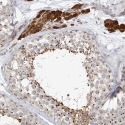 Invitrogen ZCCHC4 Polyclonal Antibody 100 &mu;L; Unconjugated:Antibodies,