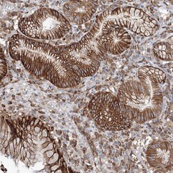 Invitrogen FBXL8 Polyclonal Antibody 100 &mu;L; Unconjugated:Antibodies,