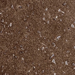 Invitrogen RASGEF1A Polyclonal Antibody 100 &mu;L; Unconjugated:Antibodies,