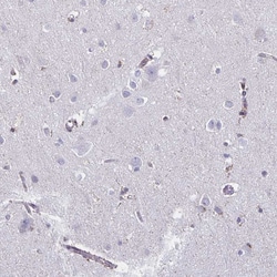 Invitrogen TRH Polyclonal Antibody 100 &mu;L; Unconjugated:Antibodies,