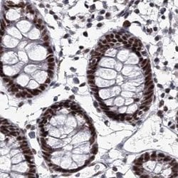 Invitrogen SCAF8 Polyclonal Antibody 100 &mu;L; Unconjugated:Antibodies,