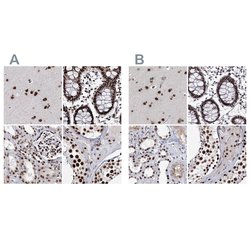 Invitrogen SCAF8 Polyclonal Antibody 100 &mu;L; Unconjugated:Antibodies,