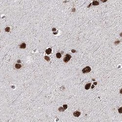 Invitrogen SCAF8 Polyclonal Antibody 100 &mu;L; Unconjugated:Antibodies,