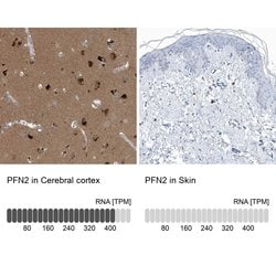 Invitrogen Profilin 2 Polyclonal Antibody 100 &mu;L; Unconjugated:Antibodies,