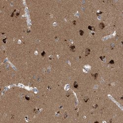 Invitrogen Profilin 2 Polyclonal Antibody 100 &mu;L; Unconjugated:Antibodies,