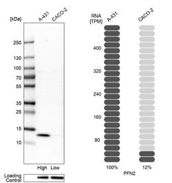 Invitrogen Profilin 2 Polyclonal Antibody 100 &mu;L; Unconjugated:Antibodies,