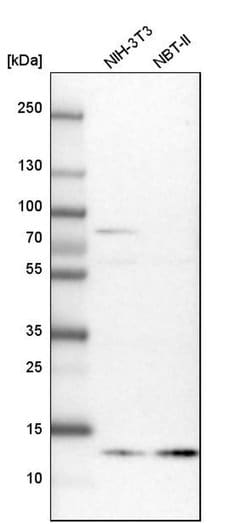 Invitrogen Profilin 2 Polyclonal Antibody 100 &mu;L; Unconjugated:Antibodies,