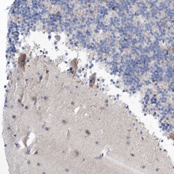Invitrogen GABRG1 Polyclonal Antibody 100 &mu;L; Unconjugated:Antibodies,