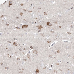 Invitrogen GABRG1 Polyclonal Antibody 100 &mu;L; Unconjugated:Antibodies,