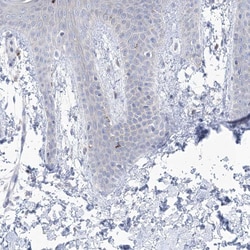 Invitrogen GABRG1 Polyclonal Antibody 100 &mu;L; Unconjugated:Antibodies,