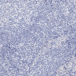 Invitrogen GABRG1 Polyclonal Antibody 100 &mu;L; Unconjugated:Antibodies,