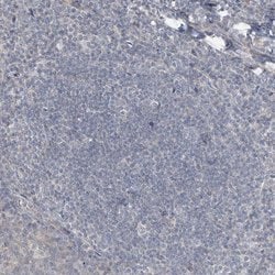 Invitrogen HOXA11 Polyclonal Antibody 100 &mu;L | Buy Online | Invitrogen&trade; | Fisher Scientific